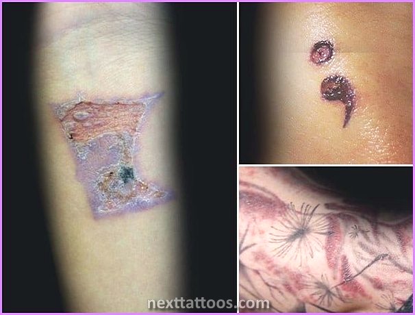 Infected Tattoo Stages
