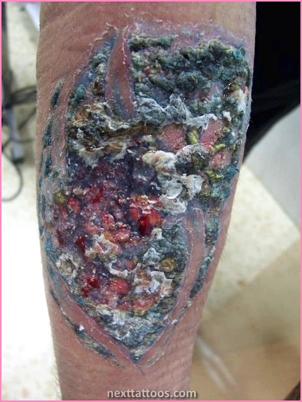 Infected Tattoo Stages